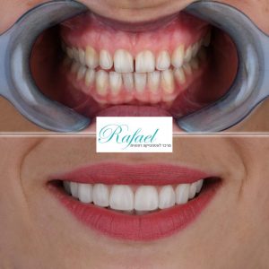 WhatsApp-Image-2022-07-18-at-23.22.53