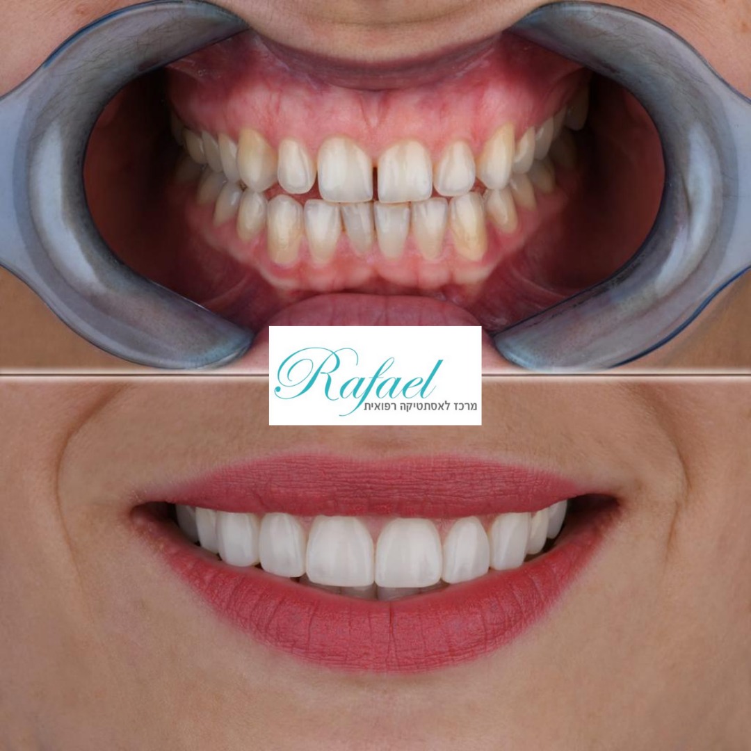 WhatsApp-Image-2022-07-18-at-23.22.53