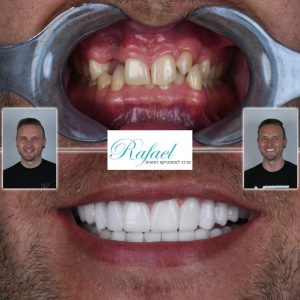 WhatsApp-Image-2022-07-18-at-23.22.54-1